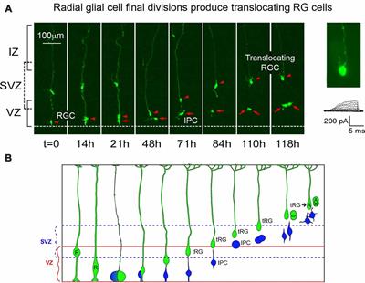 Neural Progenitor Cell Terminology